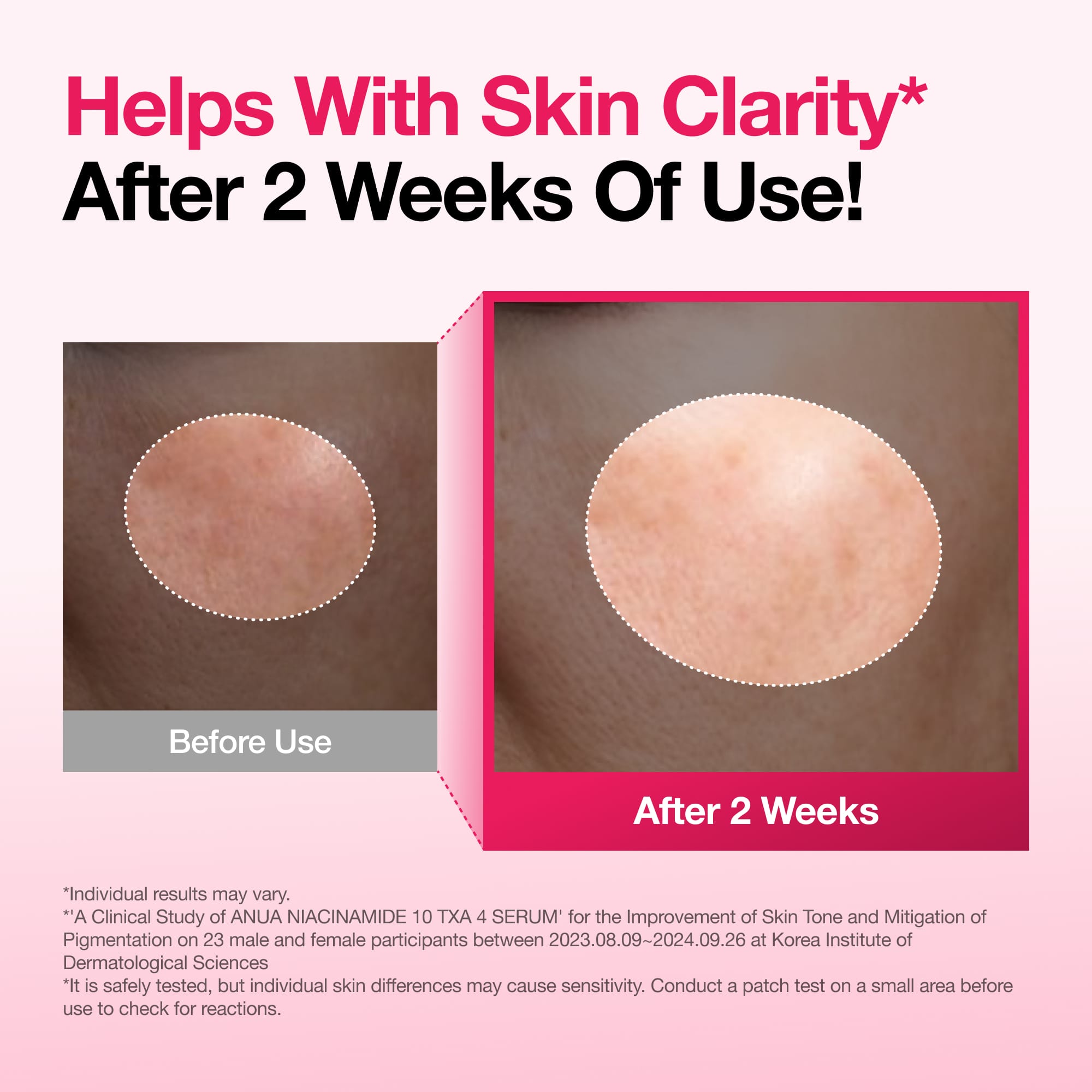 Anua Niacinamide 10% + TXA 4% Dark Spot Correcting Serum